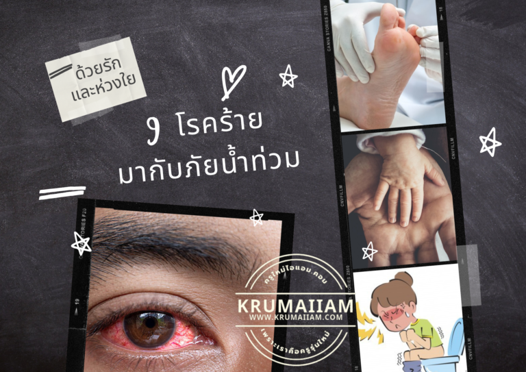 ด้วยรักและห่วงใย 9 โรคร้ายที่มากับภัยน้ำท่วม